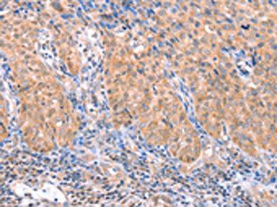 ACADS Antibody