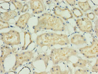 ACBD4 Antibody