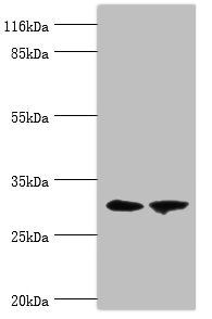 ACBD4 Antibody