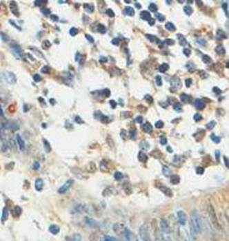 ACBD4 Rabbit Polyclonal Antibody