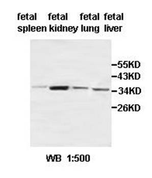 ACBD4 Rabbit Polyclonal Antibody