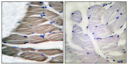 ACC1 (Phospho-Ser80) Antibody