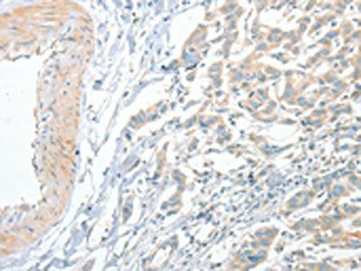 ACE Antibody