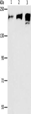 ACE Antibody