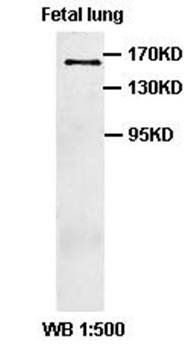 ACE1 Rabbit Polyclonal Antibody