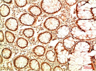 Acetyl-TP53(K382) Antibody