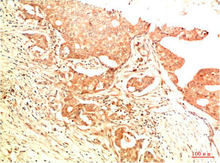 Acetyl-TP53(K382) Antibody