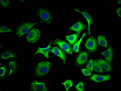 ACLY Antibody