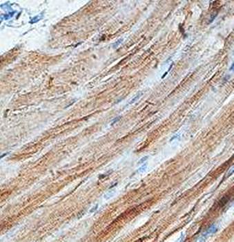 ACN9 Rabbit Polyclonal Antibody