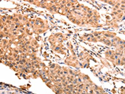 ACO2 Antibody