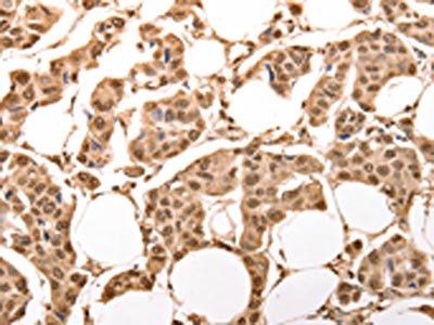 ACO2 Antibody