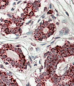 Aconitase 2 Antibody