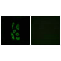 ACOT12 Antibody