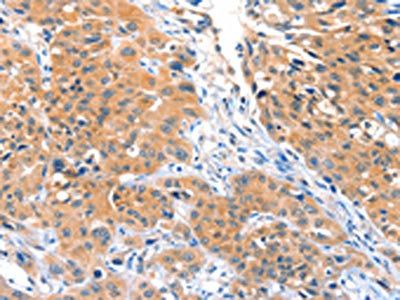 ACOX3 Antibody