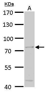 ACOX3 Rabbit Polyclonal Antibody