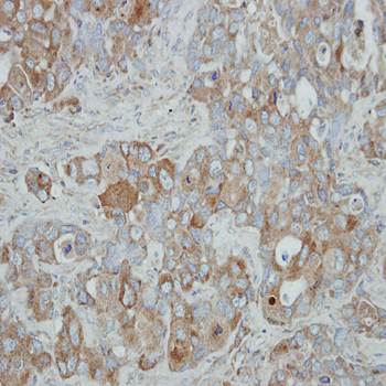 ACOX3 antibody
