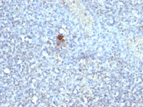 ACP5 Antibody