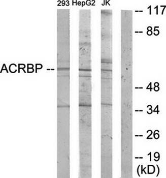 ACRBP Antibody