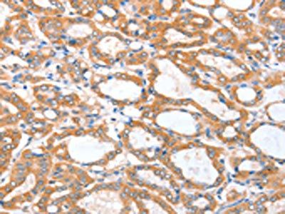 ACSBG1 Antibody