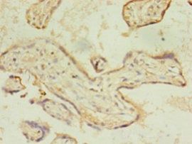 ACSL4 Antibody