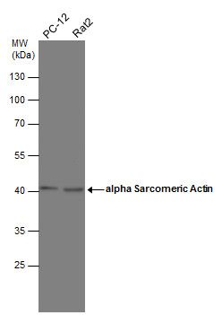 Actin Gamma 1 antibody