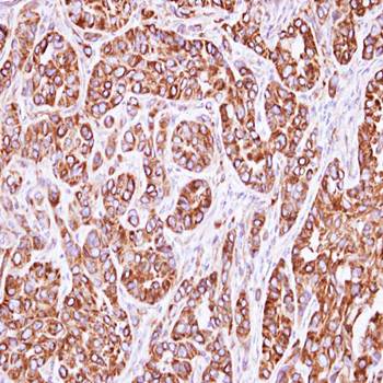 actin-like 8 antibody