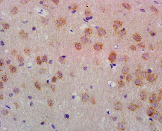 ACVR1B Rabbit Polyclonal Antibody