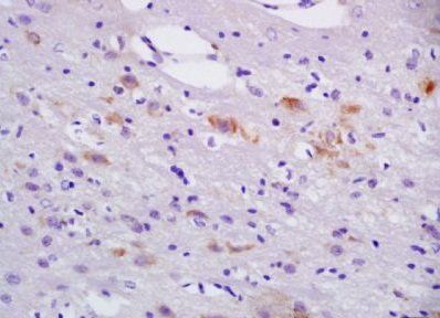 ACVR2A Rabbit Polyclonal Antibody