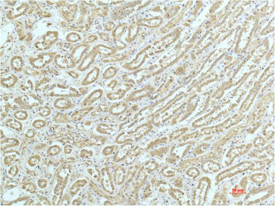ACTN1 Antibody
