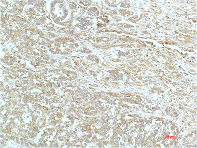 ACTN1 Antibody