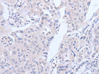 ACVR1C Antibody