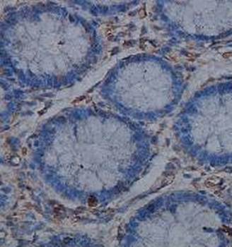 ACVR1C Rabbit Polyclonal Antibody