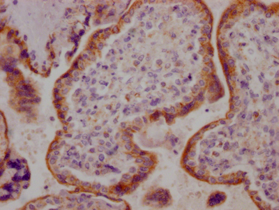 ACVR2B Antibody