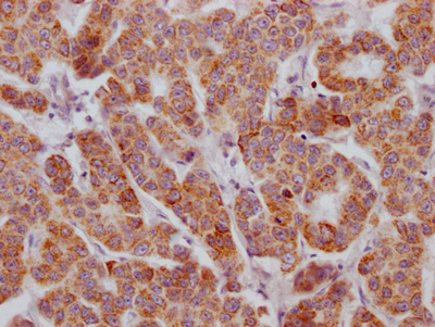 ACVR2B Antibody