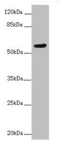 ACVRL1 Antibody