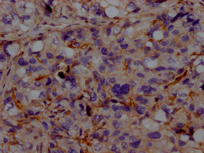ACVRL1 Antibody