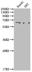 ACVRL1 Antibody