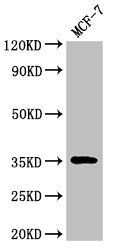 ACY3 Antibody