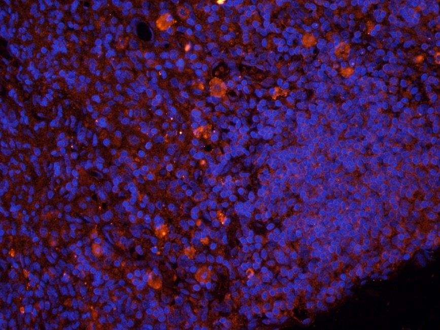 ADAM8 Rabbit Polyclonal Antibody