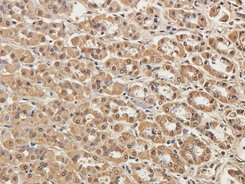 ADAM8 Rabbit Polyclonal Antibody