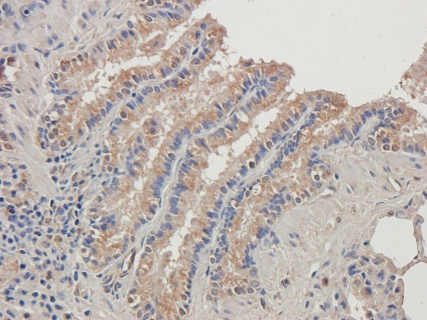 ADAM8 Rabbit Polyclonal Antibody