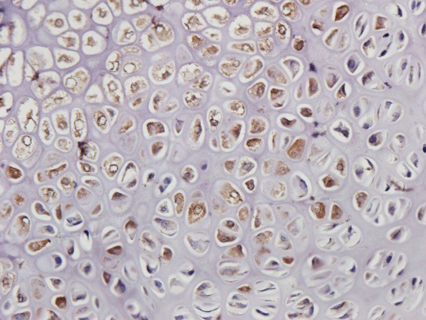 ADAM8 Rabbit Polyclonal Antibody