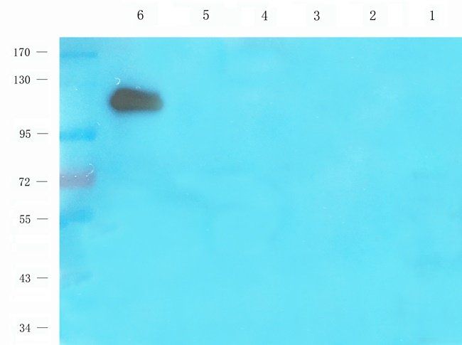 ADAM8 Rabbit Polyclonal Antibody