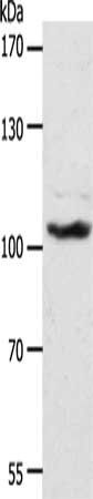 ADAMTS17 Antibody