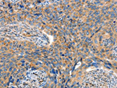 ADAMTS18 Antibody