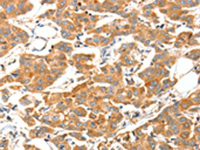 ADAMTS18 Antibody