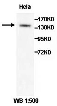 ADAMTS18 Rabbit Polyclonal Antibody