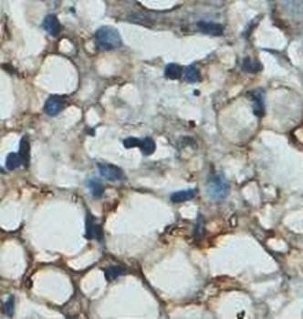 ADAMTS18 Rabbit Polyclonal Antibody