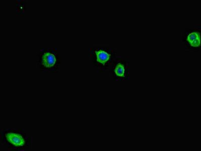 ADCY1 Antibody