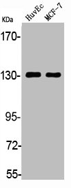 ADCY1 Antibody
